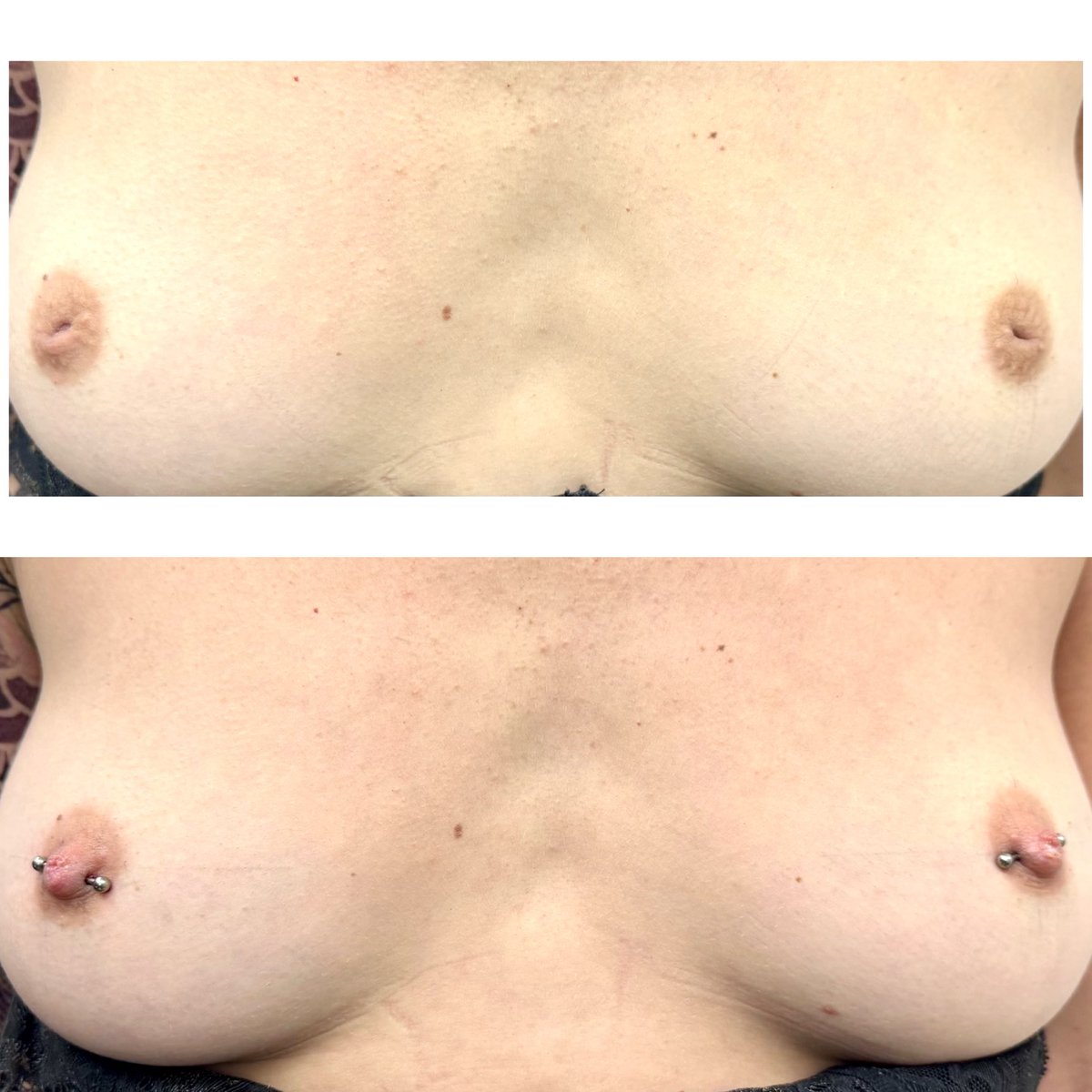 ak_darrell's tweet photo. Correzione capezzoli introflessi
#nipple #nipplespiercing #piercing # piercings https://t.co/c8LZzp8s0s