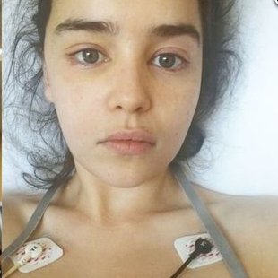 Cultination1's tweet image. 🏴󠁧󠁢󠁥󠁮󠁧󠁿🐉Elle a fait naître les dragons dans l’imaginaire mondial tout en luttant secrètement contre la mort : le calvaire d’Emilia Clarke

En février 2011, Emilia Clarke, fraîchement couronnée Mère des Dragons, s’effondre dans une salle de sport londonienne. À l’hôpital, on lui…