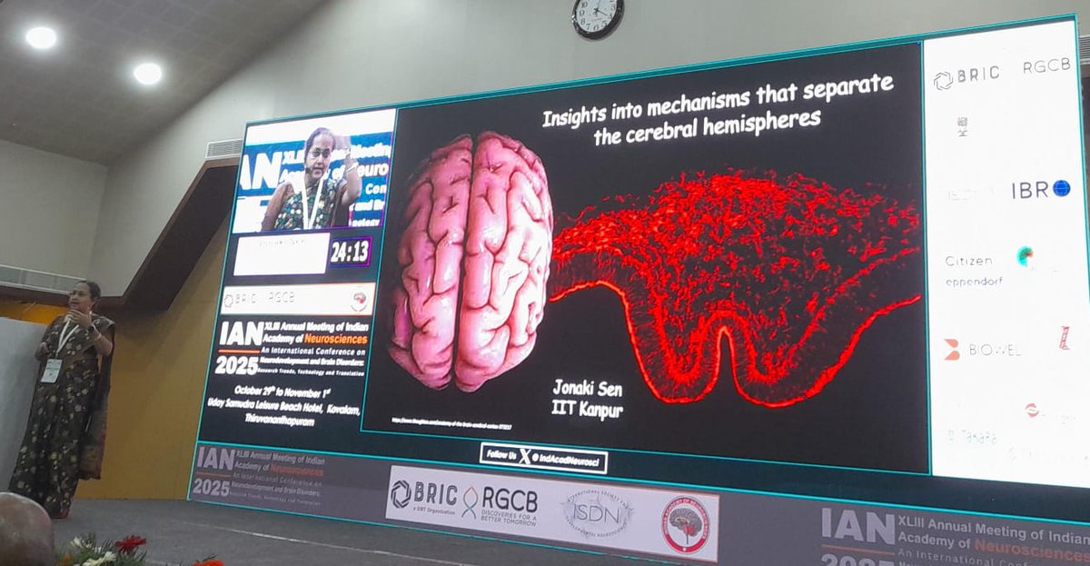 WormlockHolmes's tweet image. Failure of roof plate invagination (RPI)= holoprosencephaly. What r the forces &amp;amp; molecular mechanisms lead to RPI: differential cell proliferation &amp;amp; thickness. Simulations suggest both needed+ differential stiffness (seen exptly too) @sen_jonaki @IITKanpur #IAN25 @IndAcadNeurosci