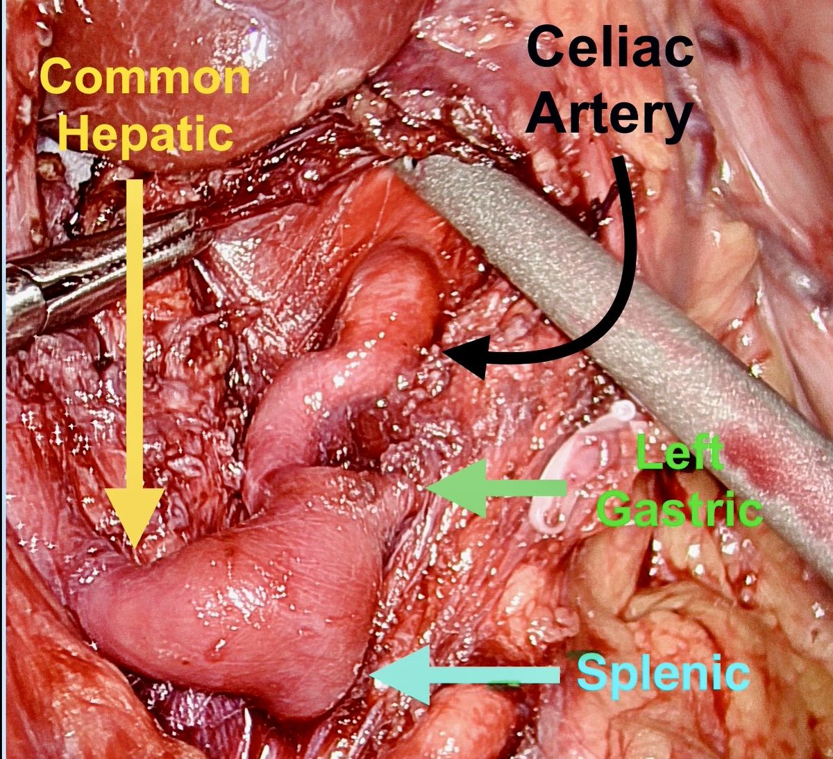 Omar M Ghanem tweet media