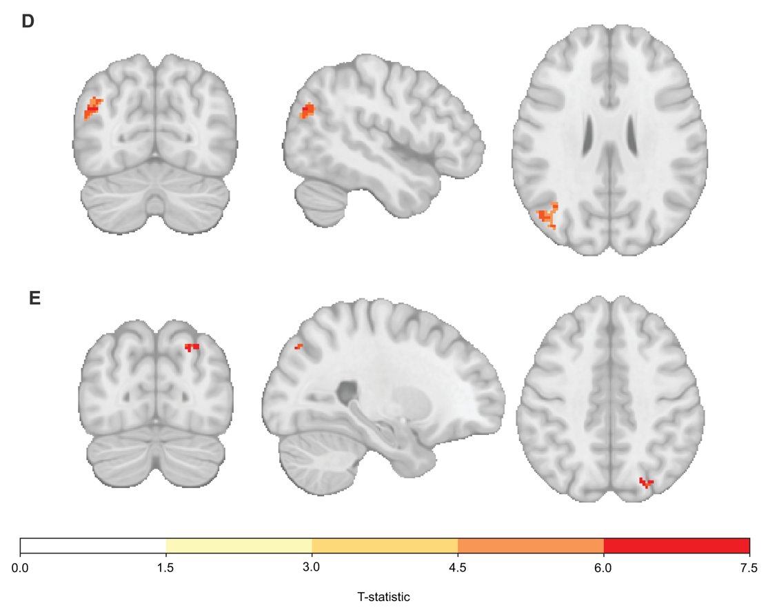 NTFabiano's tweet image. Your brain is still impacted by lack of sleep from 2 weeks ago.

Prioritize rest to maximize productivity.