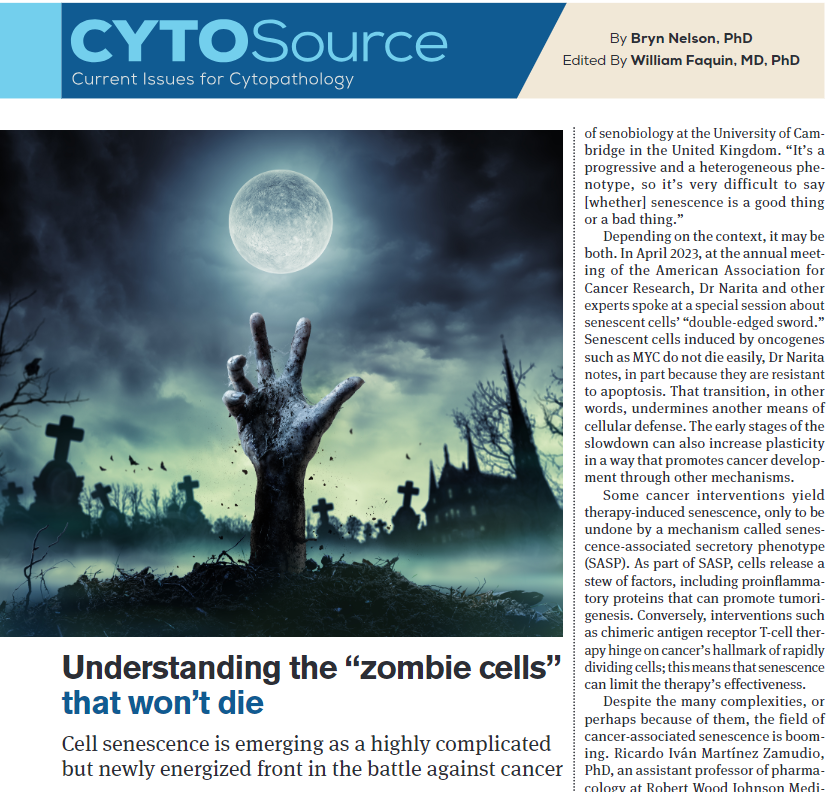 CancerCytopath's tweet photo. Happy Halloween, #CytoPaths! ๐ Cell senescence is emerging as a highly complicated but newly energized front in the battle against cancer because these โzombieโ cells refuse to die easily ๐ง
Revisit a very spooky edition of #CytoSource: https://t.co/LeSANqvM7E @bfaquin https://t.co/2bCxfH6yeQ