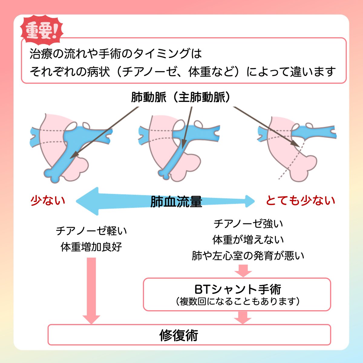JSPCCS's tweet image. 公式Instagramからです！

今回は…

＼ファロー四徴症の治療について／

どんな時にBTシャント？どんな時にラステリ手術？
同じファロー四徴症でも、手術の術式や手術のタイミングが違います。

↓↓ 説明はこちら ↓↓
instagram.com/p/DQeQ1kik_xn/…

#ファロー四徴症
#日本小児循環器学会