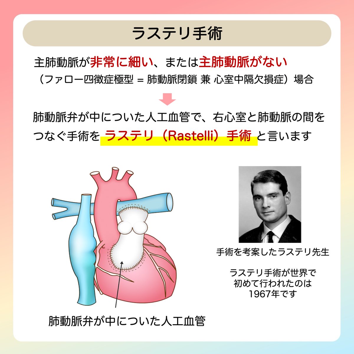 JSPCCS's tweet image. 公式Instagramからです！

今回は…

＼ファロー四徴症の治療について／

どんな時にBTシャント？どんな時にラステリ手術？
同じファロー四徴症でも、手術の術式や手術のタイミングが違います。

↓↓ 説明はこちら ↓↓
instagram.com/p/DQeQ1kik_xn/…

#ファロー四徴症
#日本小児循環器学会