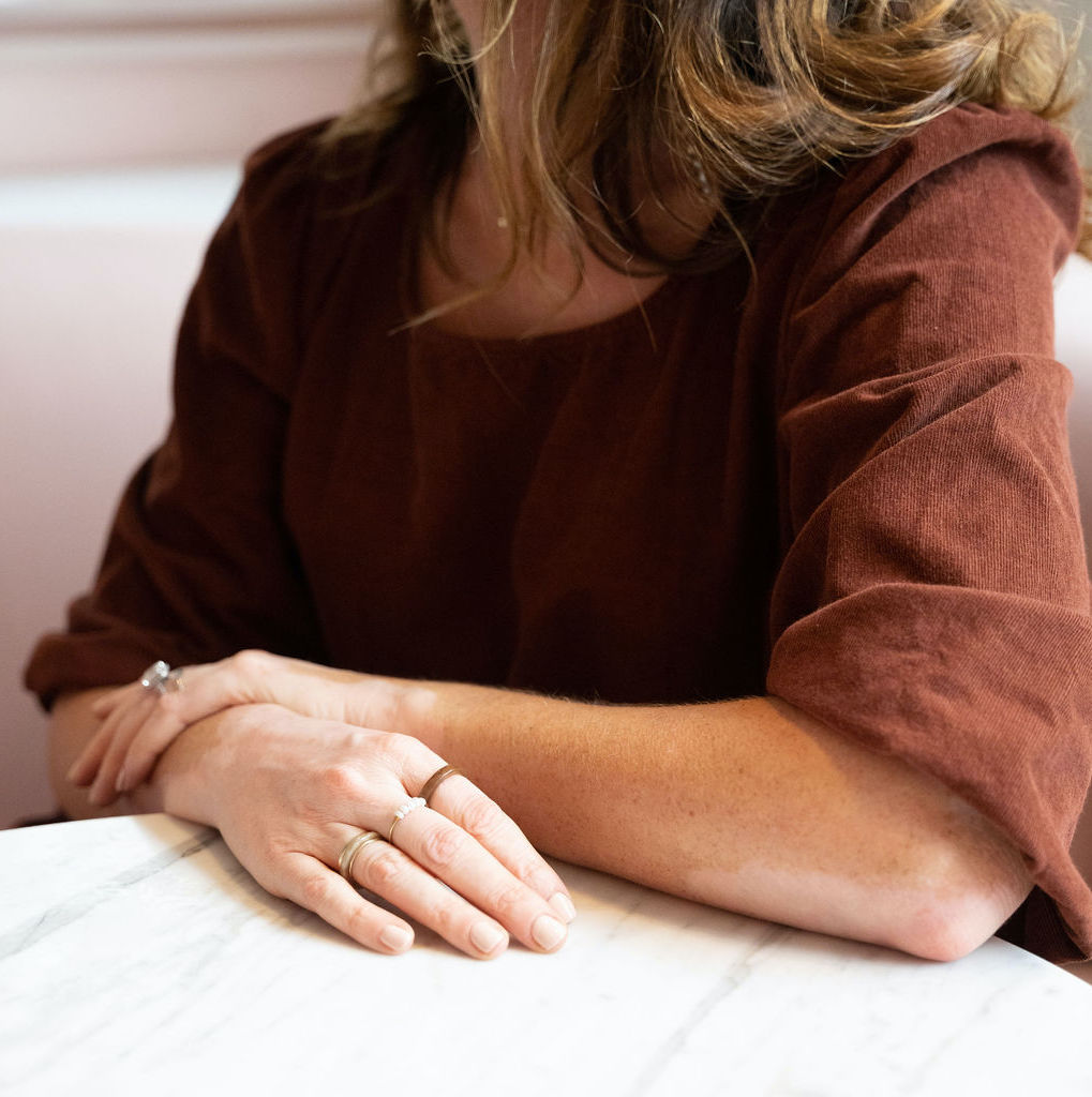 Living Dappled tweet media