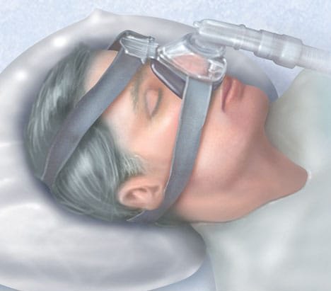 تحليل علمي لمجموعة كبيرة من المرضى يظهر أن استخدام جهاز التنفس المساعد (السيباب، CPAP) يُحدث فارقاً واضحاً في صحة مرضى توقف التنفس أثناء النوم، حتى عند الالتزام الجزئي:

شملت الدراسة ااضخمة 377,830 مريض انقطاع التنفس أثناء النوم مع أمراض مزمنة (السدة الرئوية، السكري، الاكتئاب،