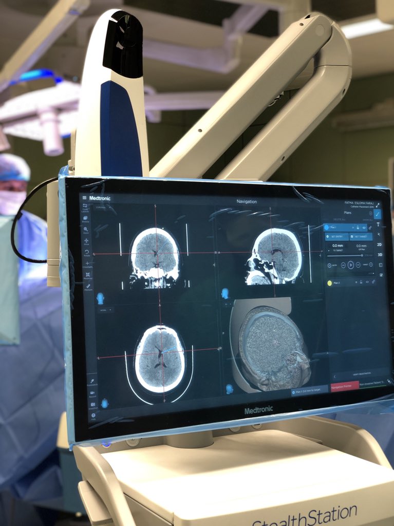 FouziRiham's tweet image. Anaesthesia Rotation ☑️
شهر الوقوع وبشدة في حُب قسم التخدير💉🤍