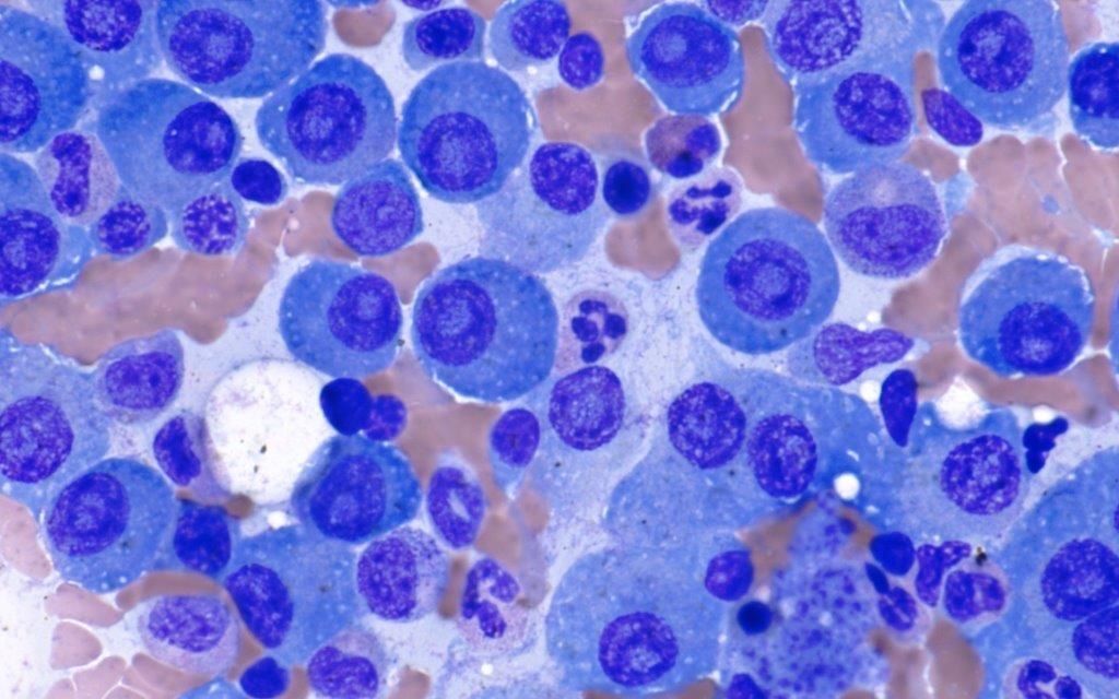 feldstej's tweet image. #fridaythoughts #fridayvibes #happyhalloween #hemepath #pathtwitter #medtwitter #digitalpath
