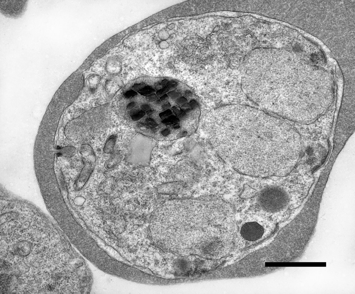 Spotlighting stranger-than-fiction science this Halloween. Blood-invading parasites are full of crystals that mysteriously dance on their own. This eerie motion has baffled scientists for decades, but researchers have finally cracked the case.
healthcare.utah.edu/newsroom/news/…
