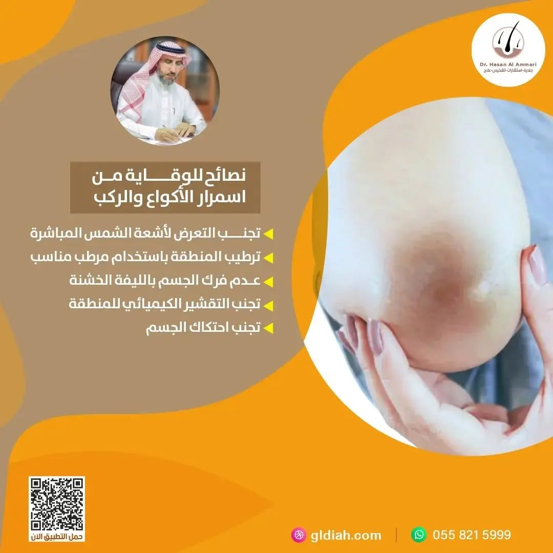 نصائح للوقاية من اسمرار الأكواع والركب 

🔸تجنب التعرض لأشعة الشمس المباشرة.

🔸 ترطيب المنطقة باستخدام مرطب مناسب .

🔸 عدم فرك الجسم بالليفة الخشنة.

🔸تجنب التقشير الكيميائي للمنطقة .

🔸 تجنب احتكاك الجسم .

#جلد #جلدية_تجميل
#جلدية #مشكلات_جلدية
#كاريزما76