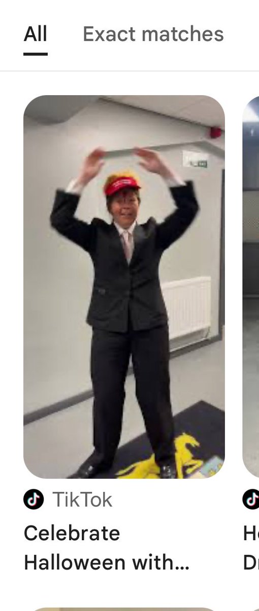 IrvingMetro1's tweet image. Meet Ella Mae Wilson: Lights on, nobody home": Blank, thousand-yard stare with a creepy forced grin. Eyes slightly crossed/unfocused, like she's not fully processing the room. Coordination issues: Jerky, unbalanced dancing—leans side-to-side, arms don't sync, feet drag awkwardly.…