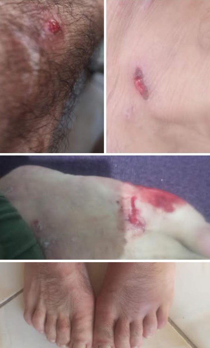 86 milyon Allah'ını kitabını kaybetmiş zenginler adım kemal soyadım tuzcu Küçükçekmece deyim ulan korkak reziller para için her şeyini verecek reziller bir engelli çocukla babasına sahip cikamadiniz lan Allah belanızi versin ulan 05336343309 arayın buradayım