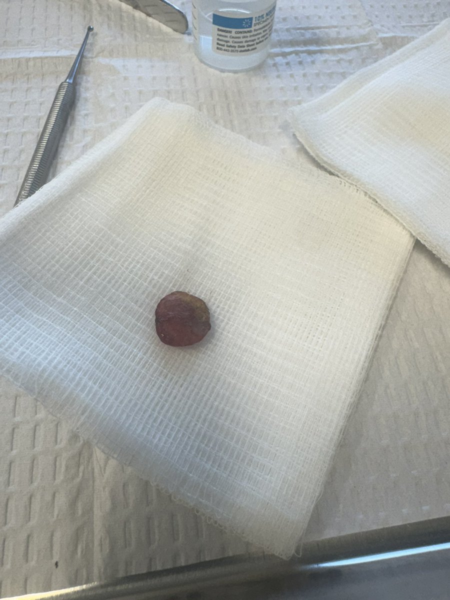 CoreyBBrooks's tweet image. Day 62 — Even with this heel issue, the mission doesn’t stop. I’m in the boot for two days, healing up and getting ready to walk strong through Richmond, Virginia on Monday. Nothing can stop purpose! 🙏🏾
#WalkAcrossAmerica #ProjectHOOD #OneMillionSteps
Projecthood.org