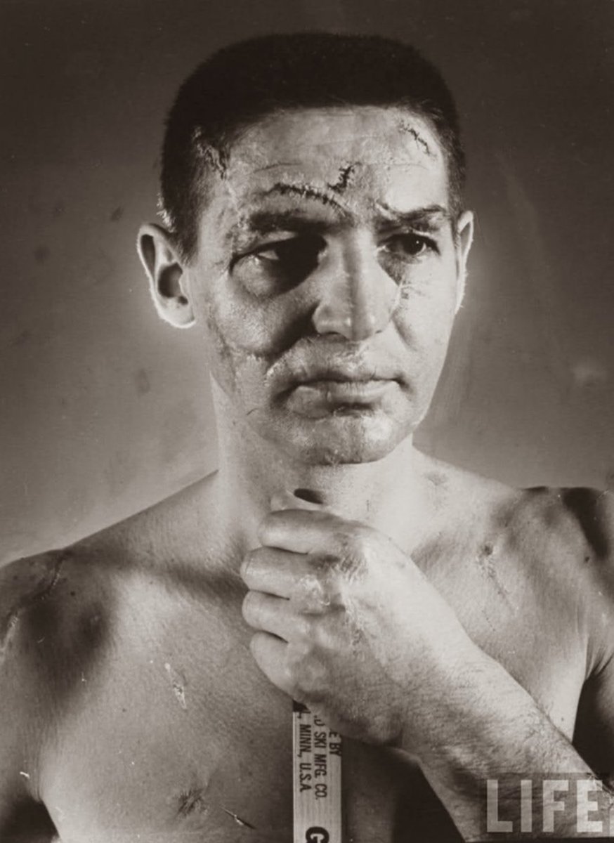 Hockey goalie Terry Sawchuk before face masks became standard in the NHL. (‘66)