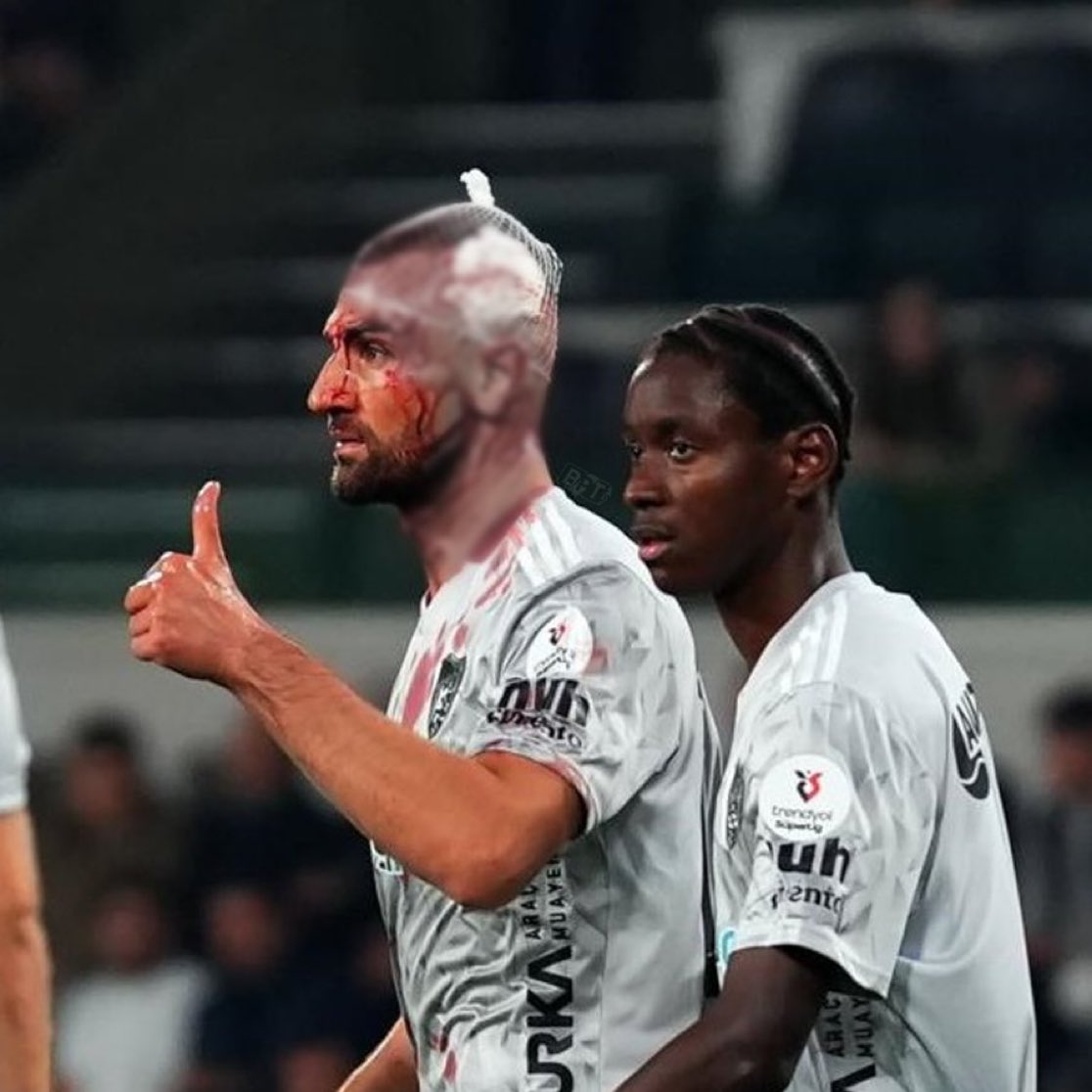 Kocaelispor futbolcusu Serdar Dursun, maçın 9. dakikasında başından ciddi şekilde yaralanmasına rağmen oynamaya devam ediyor.

Akan kanlar nedeniyle 3 kez forma değiştirdi.