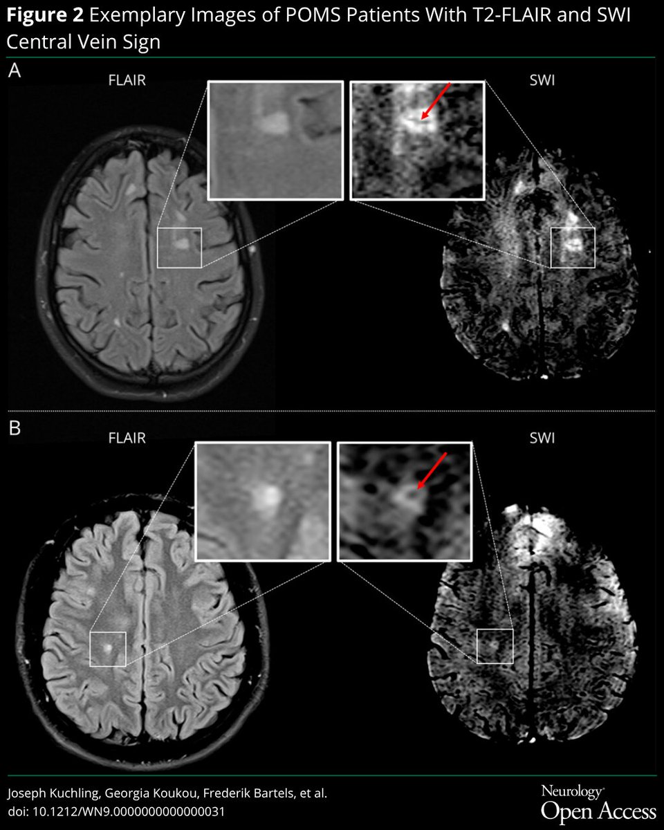 Neurology Journal tweet media