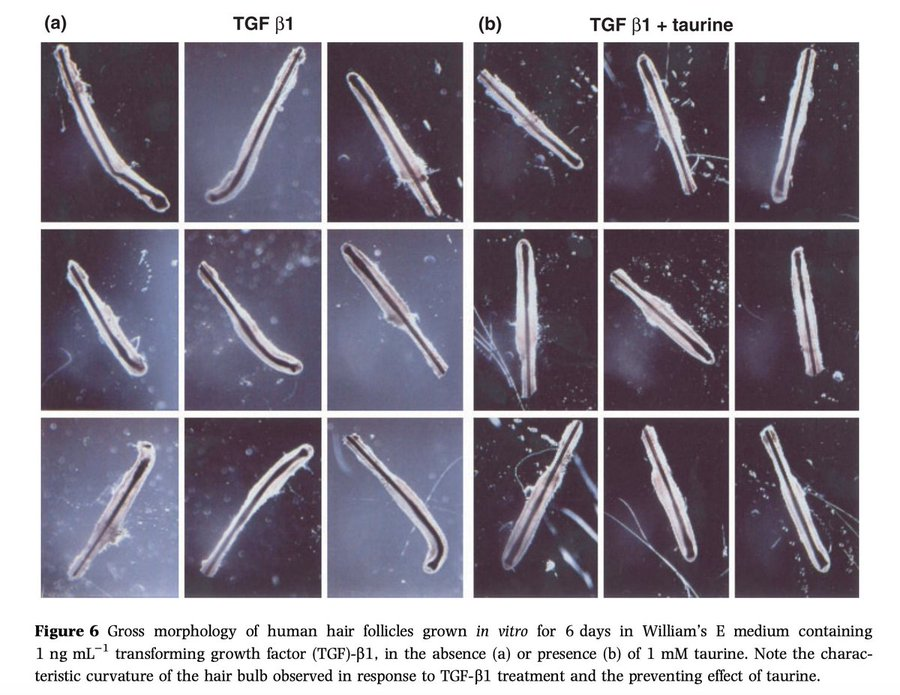 Taurine is the new creatine

- Enhances ATP production
- Improves Cellular hydration
- Boosts Cardio fitness
- Prevents hair loss
- Improves insulin sensitivity
- Lowers Blood pressure
- Regulates appetite

It also helps you age backwards and detox microplastics from your balls
