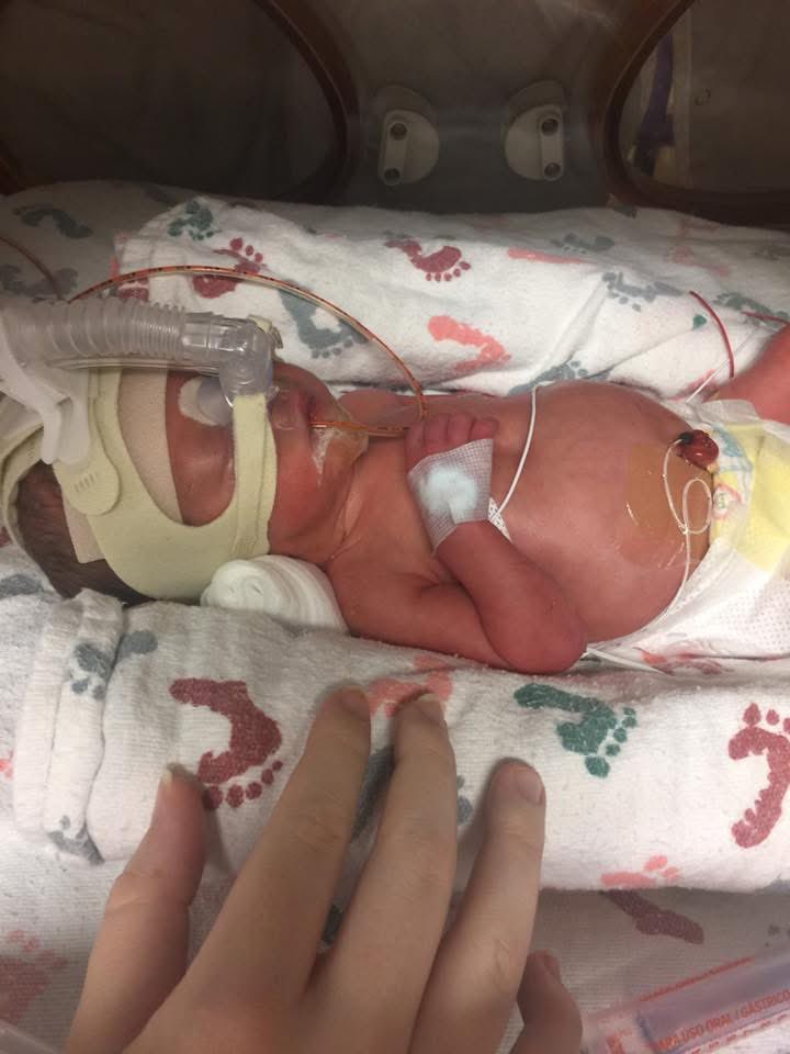 ekndad's tweet photo. @tinaturnacorner @DevinSenaUI Ma’am unfortunately you’re wrong. It’s not a fetus, it’s a baby. Define medically wrong? Because at 34 weeks a baby can be delivered and survive. For reference the picture below is my son at 31 weeks. He’s now 8 along with his twin, and is an amazing young man. https://t.co/D7bwgB2Dys