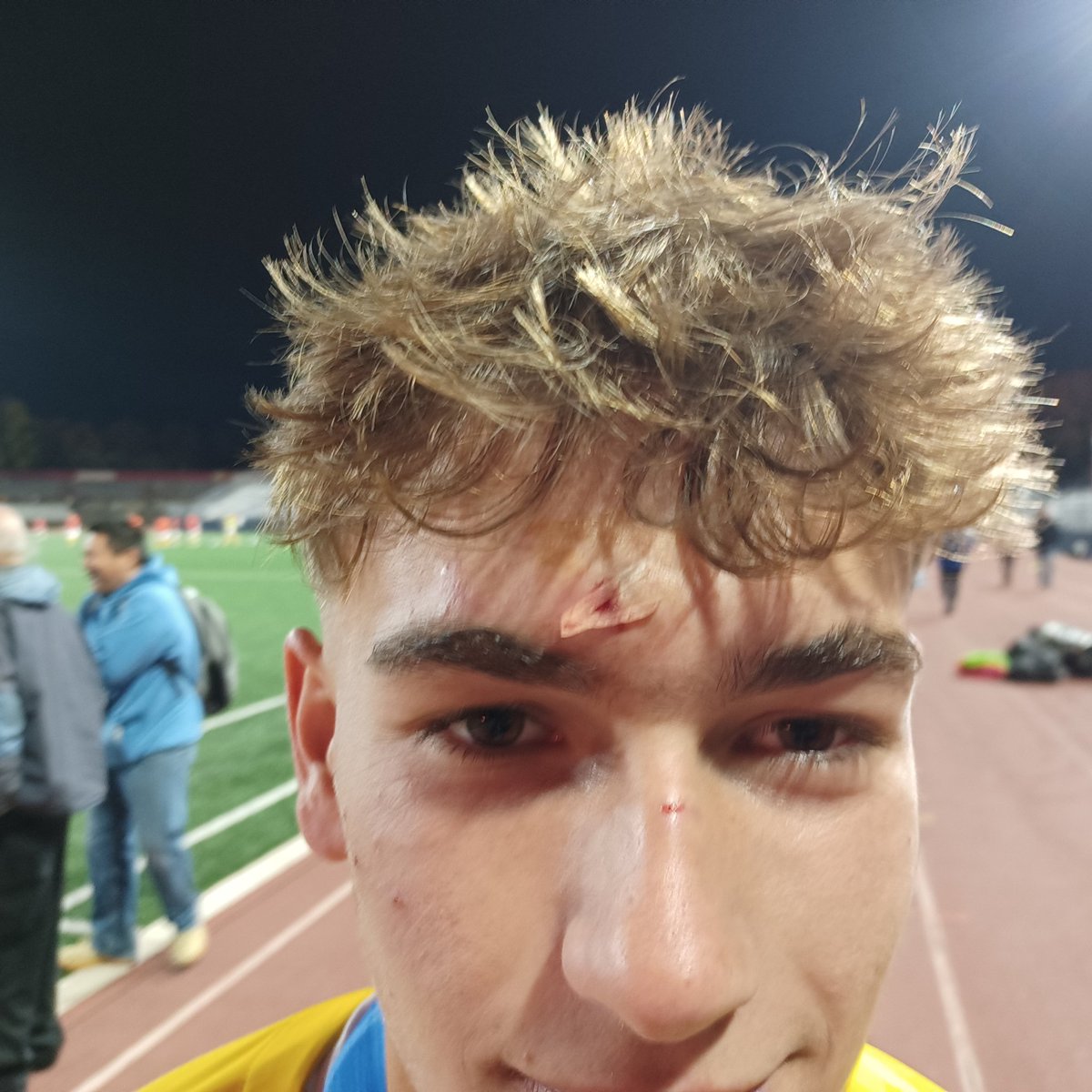Richie_Hall's tweet image. Also, a shout out to Ryan McGrath - made a kick in the shootout, made the winning save, and did this all after having to leave the game briefly after hitting the post - he said "shout out to Abby for fixing him up!"
