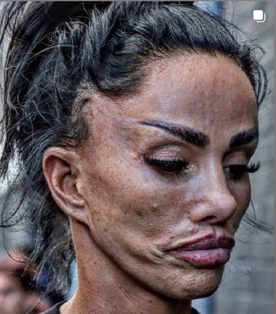 Katie Price needs to just stop 😬