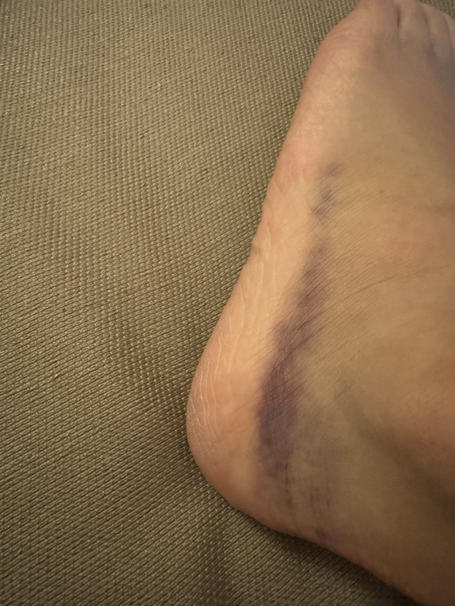 Shonen Knife Atsuko tweet media