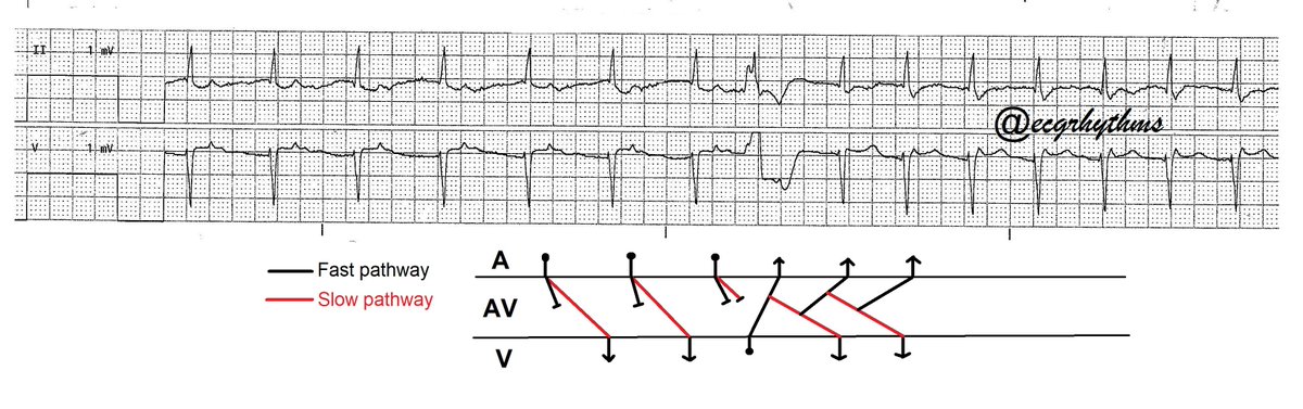 My proposed ladder diagram