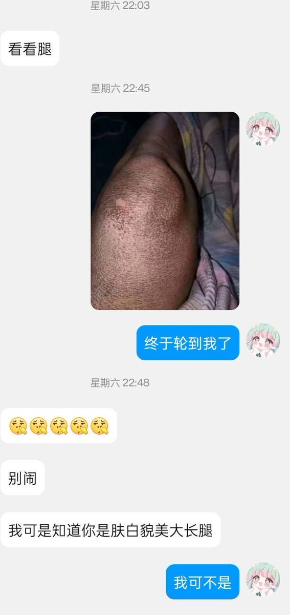 ims17508497559's tweet photo. 看看腿 https://t.co/QLr3SHCSzo