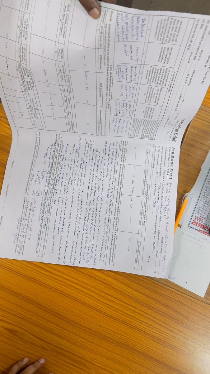 दुलारचंद यादव जी के पोस्टमार्टम रिपोर्ट में गोली लगने व गाड़ी चढ़ाने की पुष्टि हो गई है।

दलाल मिडिया की बातो पर भरोसा नही करे सतर्क रहे शावधान रहे और अनंत के आतंक का खात्मा करे।
#Arrest_Anant_Singh