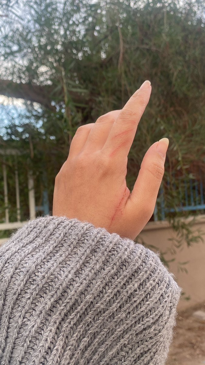 Abi nazarın değme hızı ışık hızından daha fazla