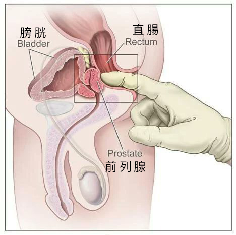 【雌堕百科：前列腺】
好多小可爱... 都还找不到自己身体里... 那个最舒服、最会让妳「上瘾」的『小开关』，对吗？

🌟妳们的「G点」呀... 其实就藏在妳们的「小穴穴」里喔。
（姊姊说的是「前列腺」啦...）

它... 是妳们通往脑内高潮的秘密通道。
🫣但它藏得很好... 妳在外面是摸不到的。