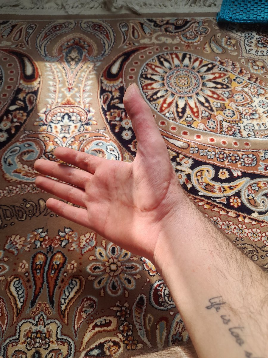 تا آخر عمرم قدردان اون دکتری که باعث شد ۵ تا انگشت داشته باشم هستم