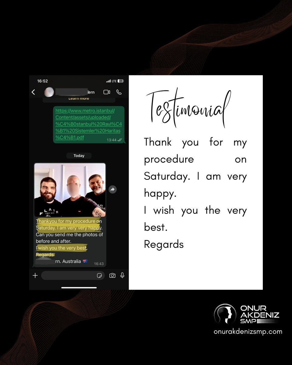onurakdenizsmp's tweet image. Grateful for another happy client 🙏
It’s always a great feeling to see smiles after the final session.
Thank you for trusting me on your SMP journey!

#scalpmicropigmentation #micropigmentation #hairmicropigmentation #smp #saçsimülasyonu #mikropigmentasyon