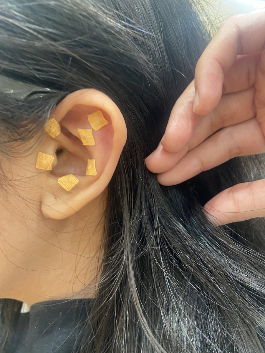semua pengobatan cina, ku selalu tertarik 😅
sekarang lagi mencoba ear acupuncture 🤣😌