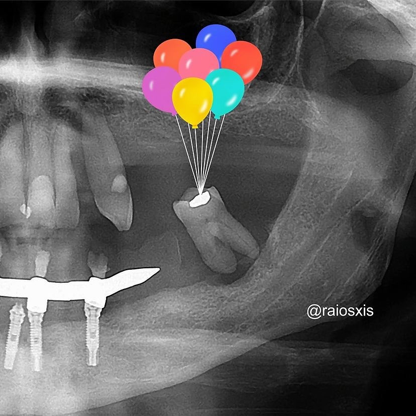 Kuşlar kuşlar nolur beni de alın