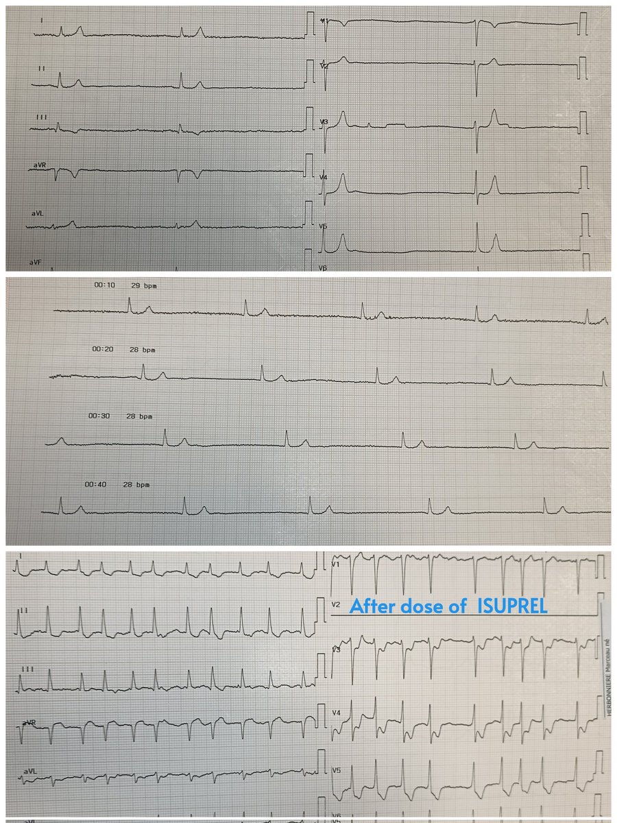 ♂️ Patient admitted with acute kidney injury (AKI); creatinine clearance (CrCl) 15 mL/min ⁉️⁉️⁉️