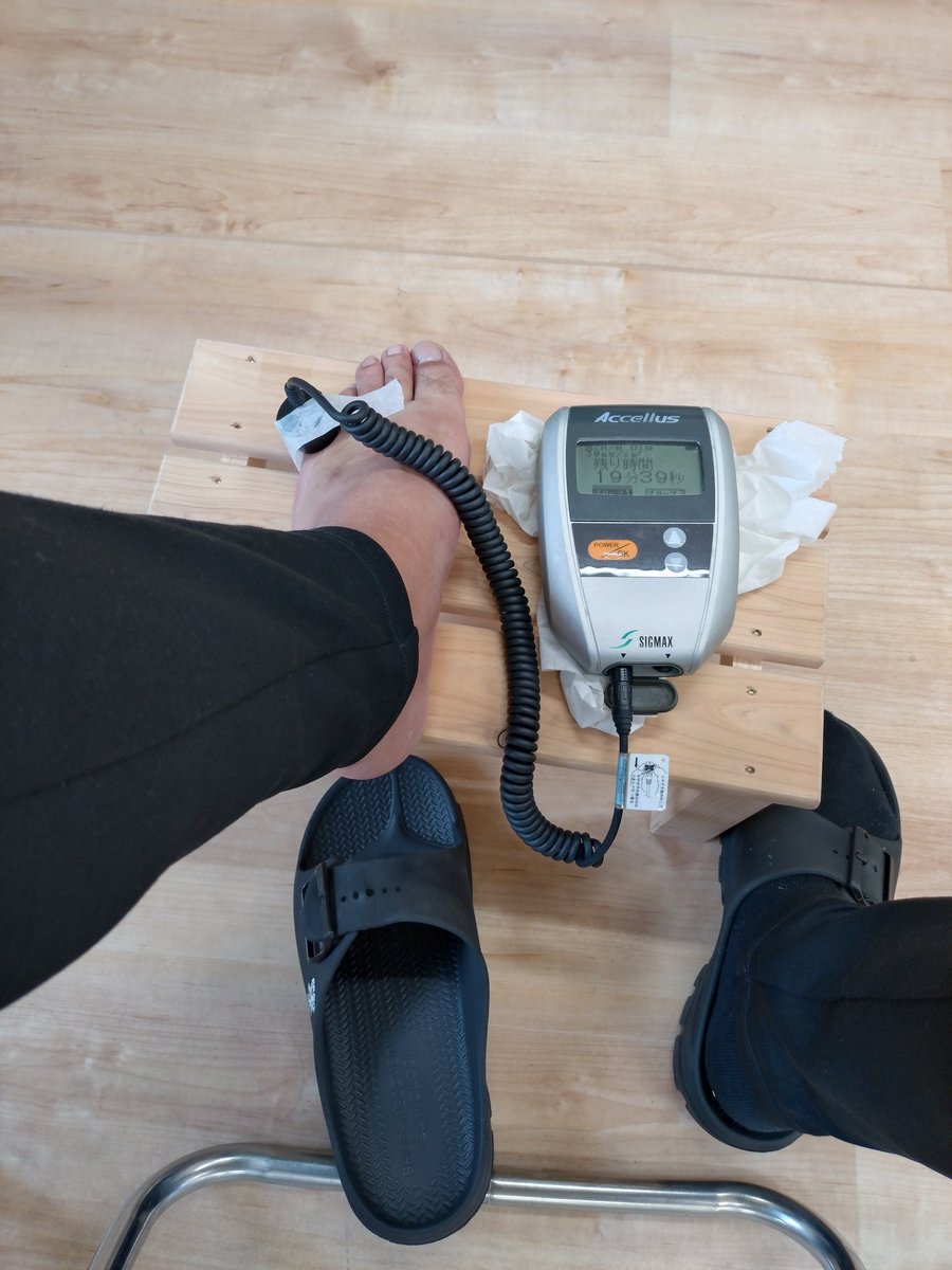 initial33a's tweet image. 今日も安定のレーザー治療。
これでホントに骨が引っ付くのが早くなるのか？？
未だ分からず。
ただ、腫れがかなり治まってます。