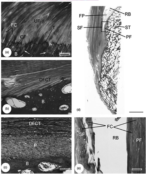 Rheumatology's tweet photo. This review celebrates the work of Professor Mike Benjamin, whose anatomical research transformed our understanding of entheses - the sites where tendons, ligaments and other connective tissues attach to bone. This review aims to provide an overview of Professor Benjamin's foundational concepts, including the enthesis organ, functional entheses and the synovio-entheseal complex and their relevance to musculoskeletal health and disease.
FREE PDF
https://t.co/8H8FyRz90v