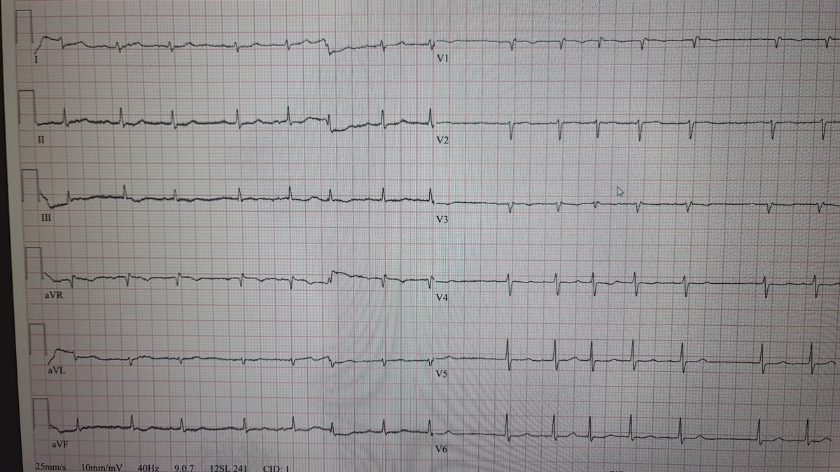 ECG Challenge tweet media