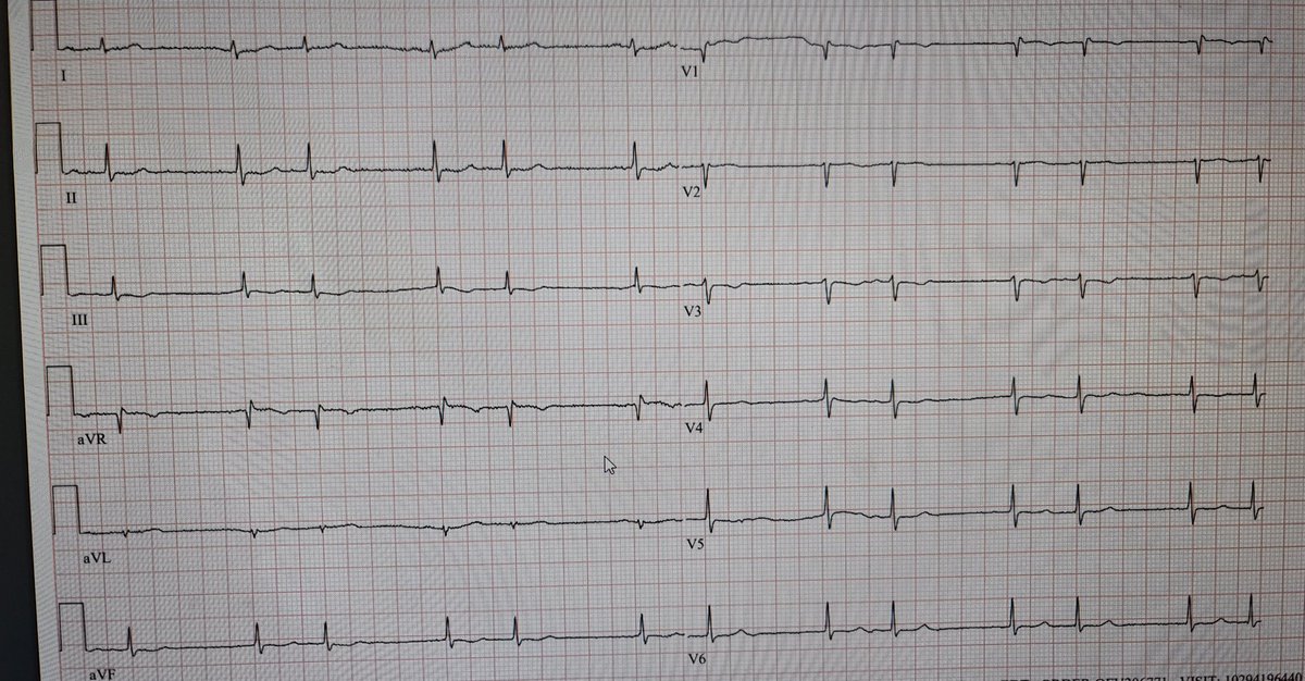 ECG Challenge tweet media