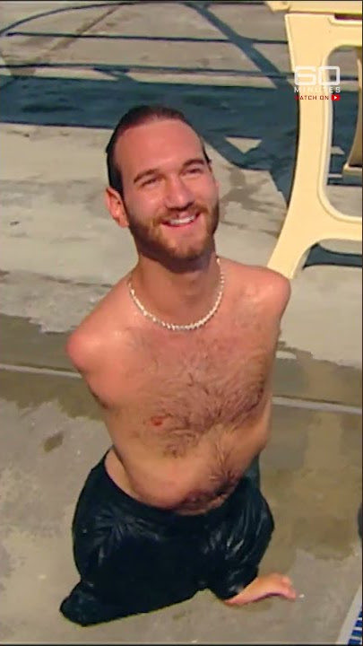 Chris_CA2's tweet image. The limbs