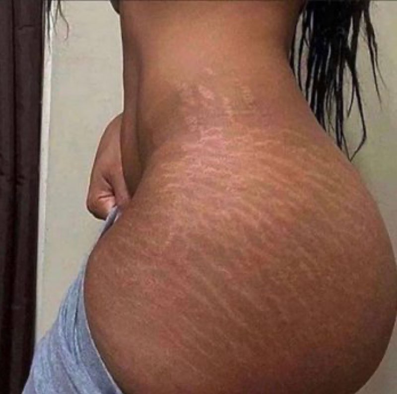 Cas 2.0🤭💕 tweet media