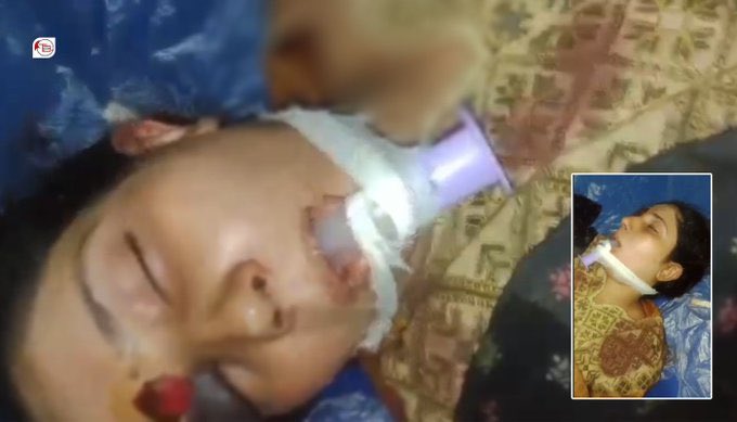 SJ_Bugti's tweet photo. Pakistani military have assaulted , raped and killed a Baloch woman in their camp in Panjgur and later dumped her body near a local hospital, 

no Media no HR organizations Pakistani army continues their inhumane and henius crimes against Baloch with full impunity, 
#Balochistan https://t.co/kPYFl9A6x4