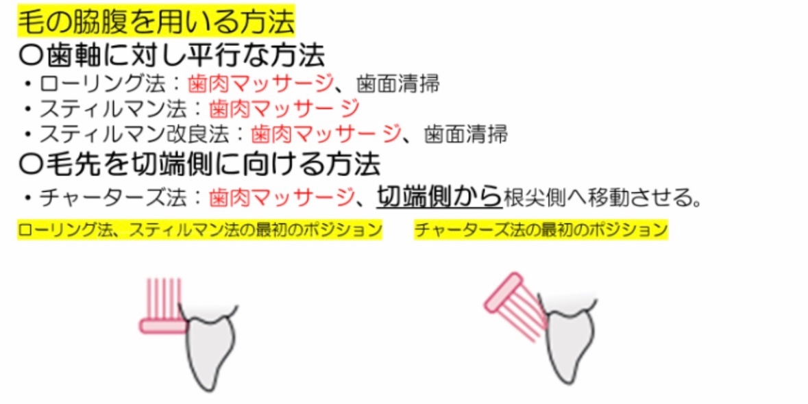 119回歯科医師国家試験対策 ロムニーハウス勉強会【講師 Dr.N