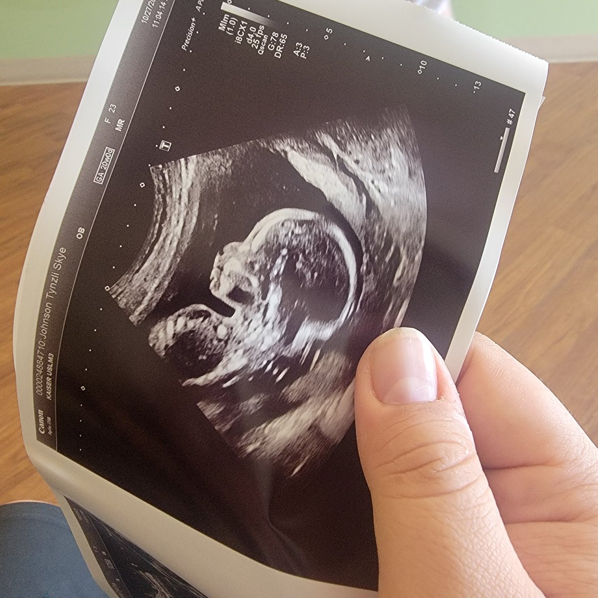 Adonutss tweet media