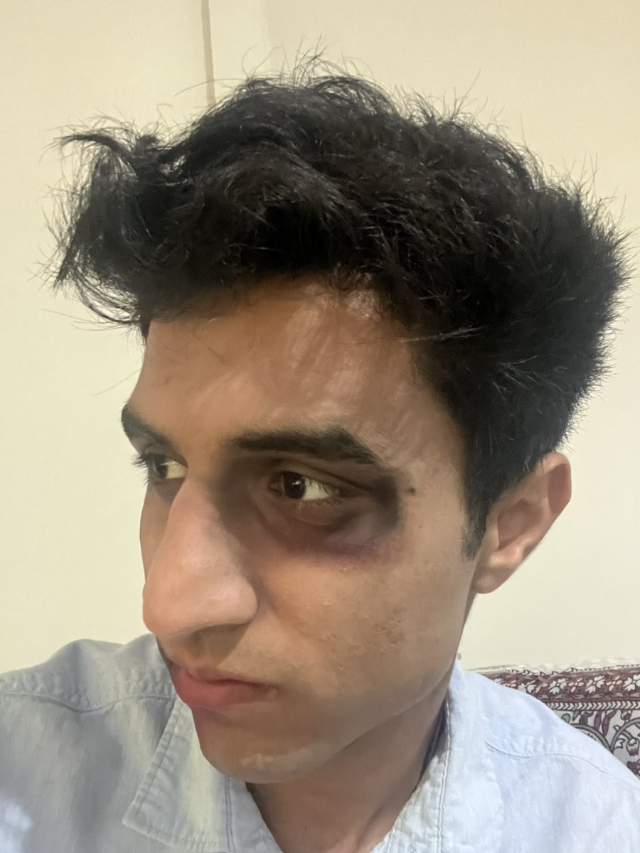 autistictushar's tweet image. 