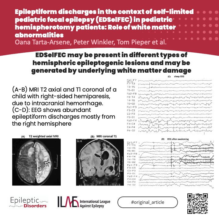 Epileptic Disorders tweet media