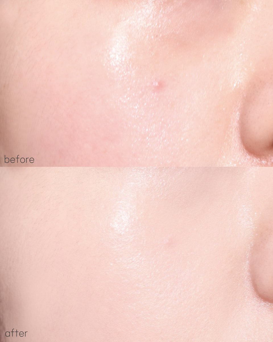 #광고 #RT이벤트
RT추첨 10분께 어퓨 워터락 컴포트 
베일 쿠션 21호 쉘 컬러를 드려요🥚💗

워터락 쿠션이 새로운 디자인과
제형으로 리뉴얼 됐어요🌟

피부에 들뜸없이 가볍게 밀착되는데 
커버력도 중상이라 깔끔하고 매끈한
피부표현으로 만들어줌👍🏻