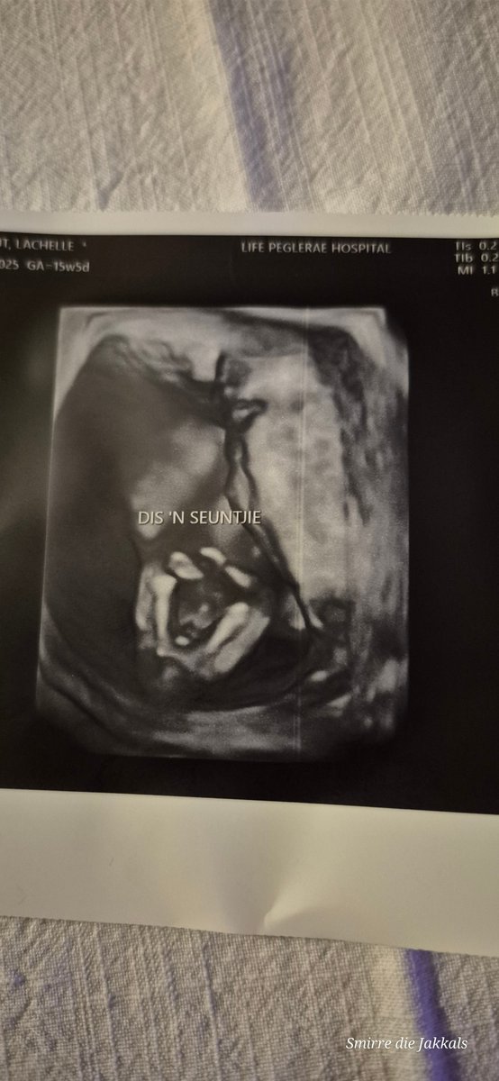 🐽Smirre die Jakkals🦊 tweet media