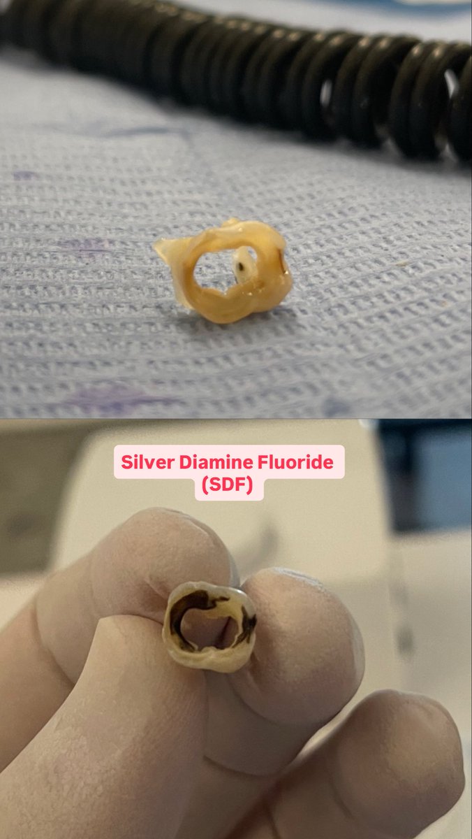 Hashim✨ tweet media