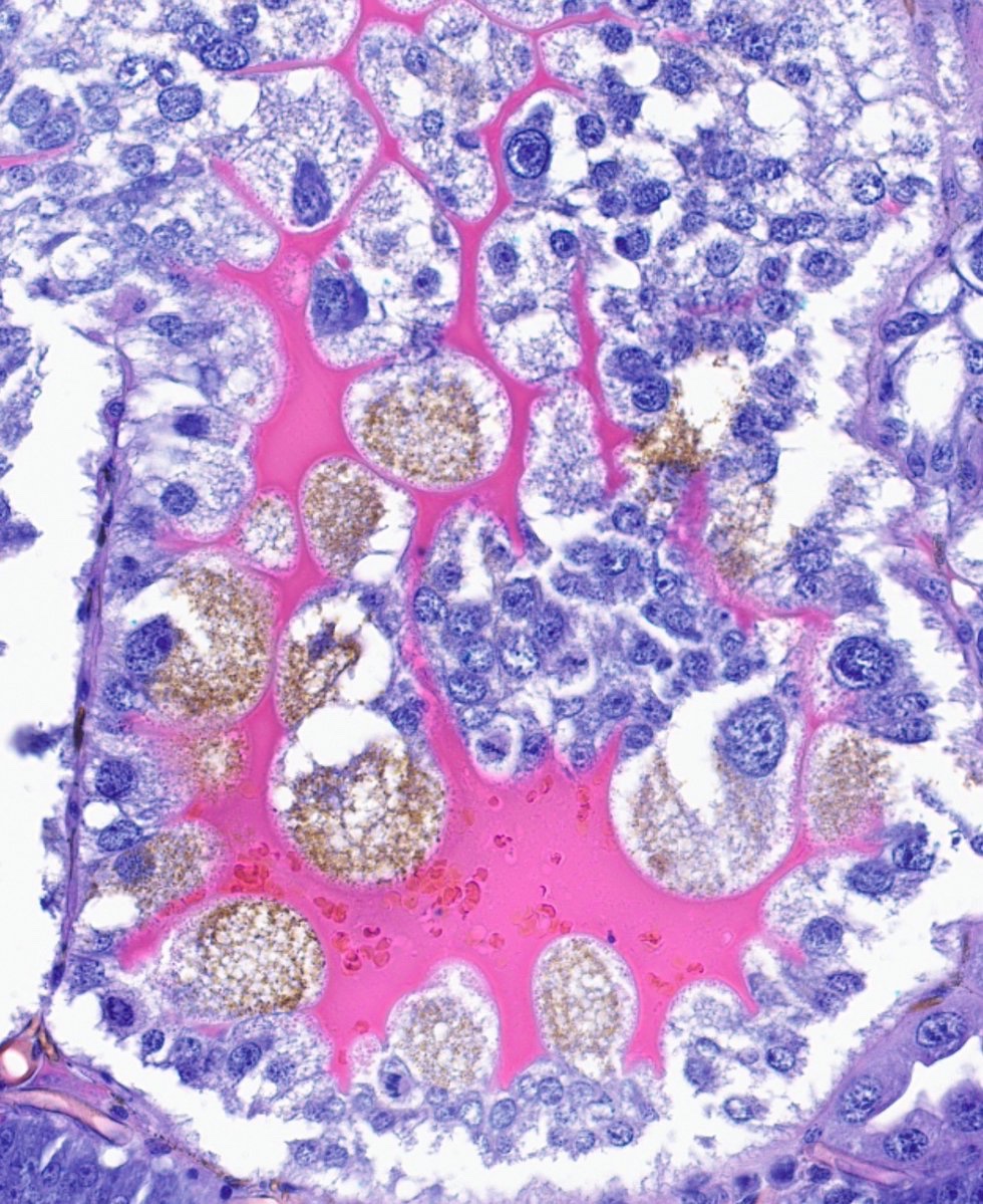 CakePath's tweet image. Alright, we have this cutie 🥰 ! 
I now have a better idea of the potential organ identification from this entomological autopsy. #pathology #pathologists #pathTwitter #dermpath #dermatologia #dermtwitter #entomology